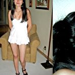 Third pic of Before and After Facials 2 - 29 Pics | xHamster