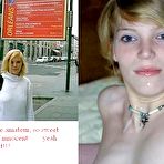 Fourth pic of Before and After Facials 2 - 29 Pics | xHamster