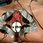 First pic of Tied up  Lisa Lee gets her pussy and tits tortured by Audrey Leigh in a hospital