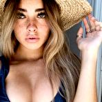 Third pic of Misc. stuff: Freckles - Sexy and Funny Forums