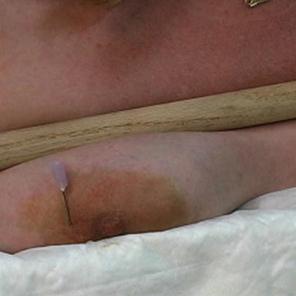 Hot Needle Play0 #363725