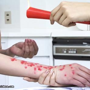 Candle Wax and Skin0 #523909